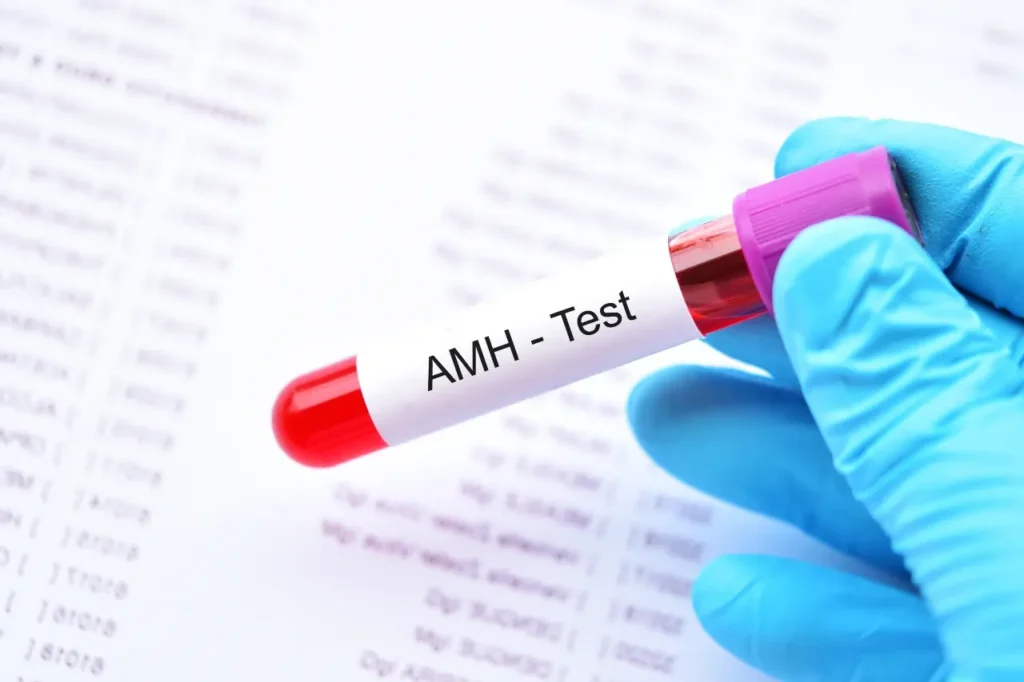 בדיקת AMH
